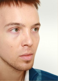 viksraitis